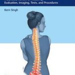 Spine Essentials Handbook  :  A Bulleted Review of Anatomy, Evaluation, Imaging, Tests, and Procedures