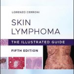 Skin Lymphoma : The Illustrated Guide