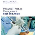 Manual of Fracture Management – Foot and Ankle
