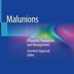 Malunions : Diagnosis, Evaluation and Management