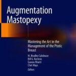 Augmentation Mastopexy : Mastering the Art in the Management of the Ptotic Breast