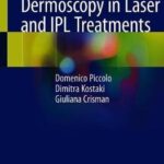 Quick Guide to Dermoscopy in Laser and IPL Treatments