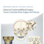 Advanced Craniomaxillofacial Surgery : Tumor, Corrective Bone Surgery, and Trauma