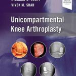 Unicompartmental Knee Arthroplasty, E-Book