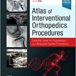 Atlas of Interventional Orthopedics Procedures: Essential Guide for Fluoroscopy and Ultrasound Guided Procedures
