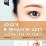 Asian Blepharoplasty and the Eyelid Crease