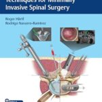 Essential Step-by-Step Techniques for Minimally Invasive Spinal Surgery