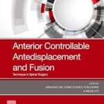Anterior Controllable Antedisplacement and Fusion (ACAF): Technique in Spinal Surgery