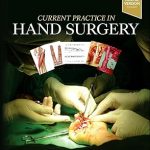 Current Practice in Hand Surgery