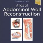 Atlas of Abdominal Wall Reconstruction 3rd Edition
